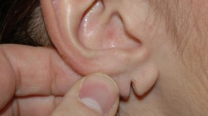 earlobe3