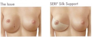 silk-image2