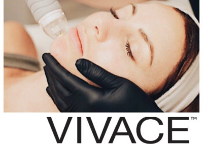 The Vicace Experience